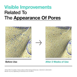 Anua BHA 2% Gentle Exfoliating Toner - Volare Makeup