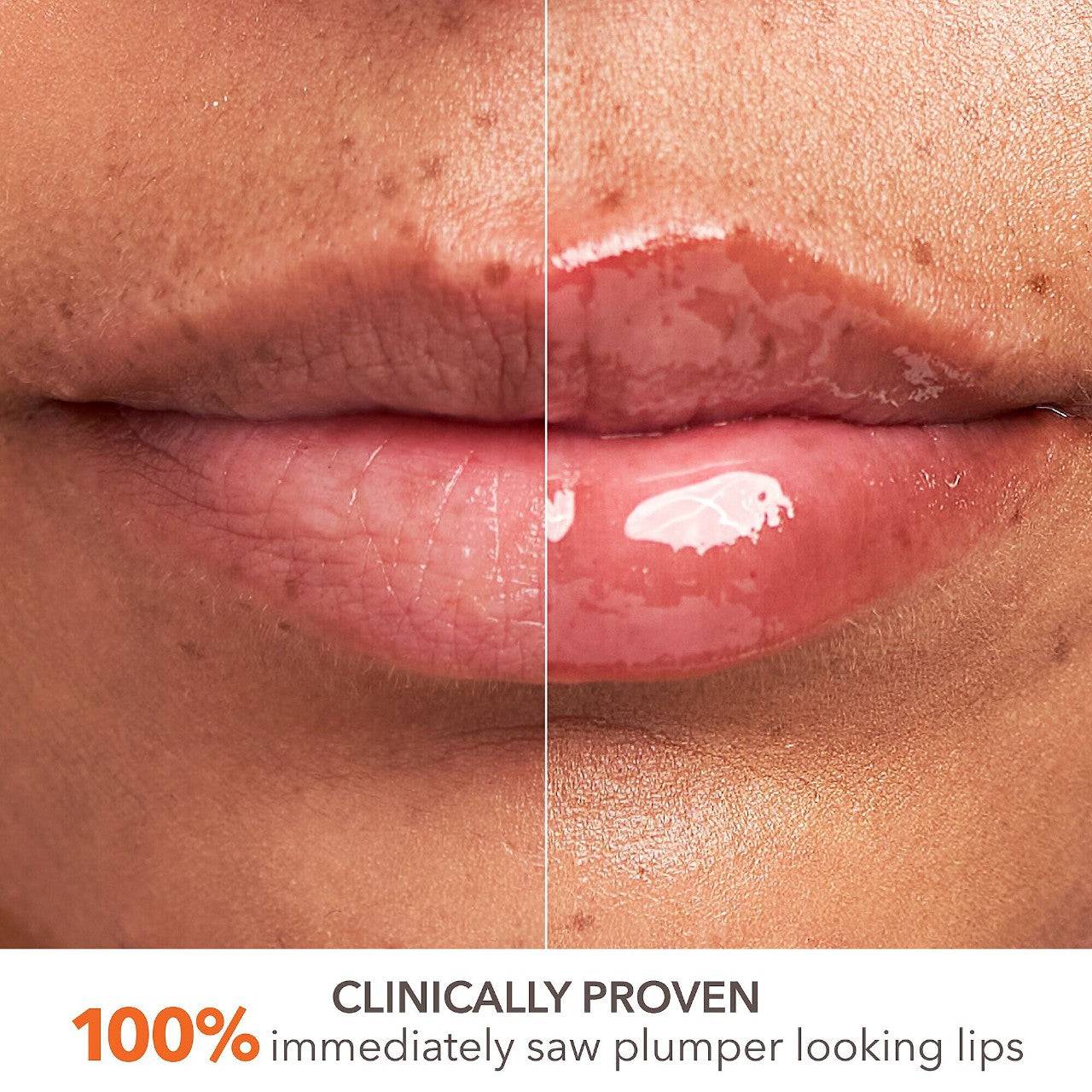 Dr. Dennis Gross Skincare DermInfusions Plump + Repair Lip Treatment with Hyaluronic Acid - Volare Makeup