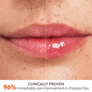 Dr. Dennis Gross Skincare DermInfusions Plump + Repair Lip Treatment with Hyaluronic Acid - Volare Makeup