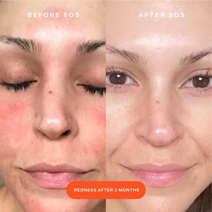 Tower 28 Beauty SOS Daily Rescue Facial Spray - Volare Makeup