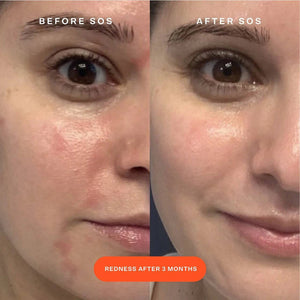 Tower 28 Beauty SOS Daily Rescue Facial Spray - Volare Makeup