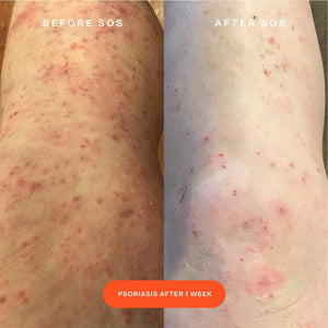 Tower 28 Beauty SOS Daily Rescue Facial Spray - Volare Makeup