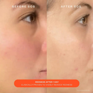 Tower 28 Beauty SOS Daily Skin Barrier Redness Recovery Moisturizer - Volare Makeup