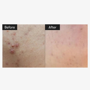 VT Reedle Shot 100 - Volare Makeup