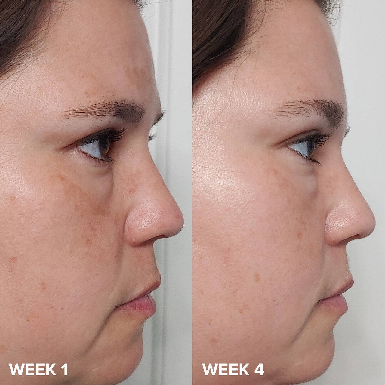 Paula's Choice Skin Perfecting 2% BHA Liquid Exfoliant - Volare Makeup