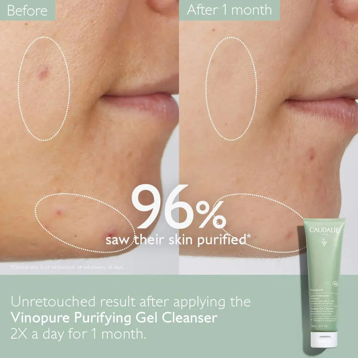 Caudalie Vinopure Pore Purifying Gel Cleanser Caudalie Gel Cleanser Volare Makeup  Gel Cleanser