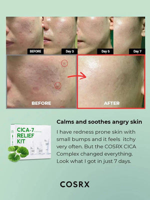 COSRX CICA-7 RELIEF KIT- 3 step - Volare Makeup