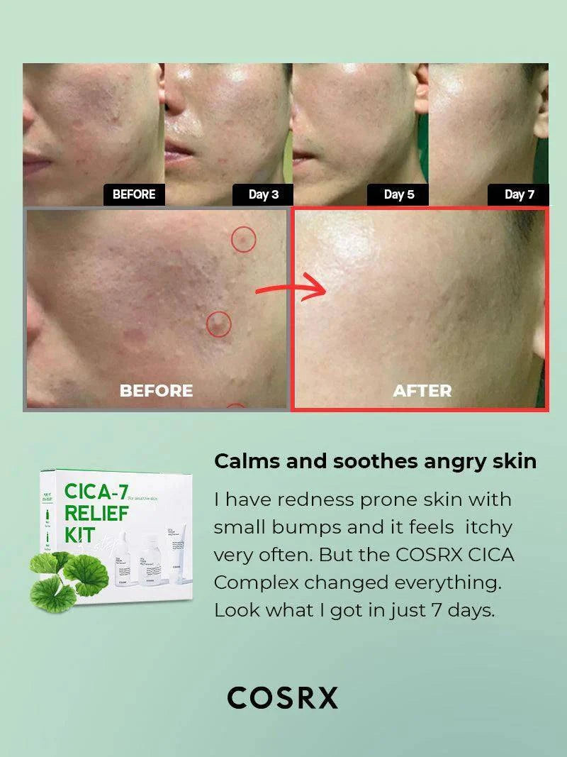 COSRX CICA-7 RELIEF KIT- 3 step - Volare Makeup