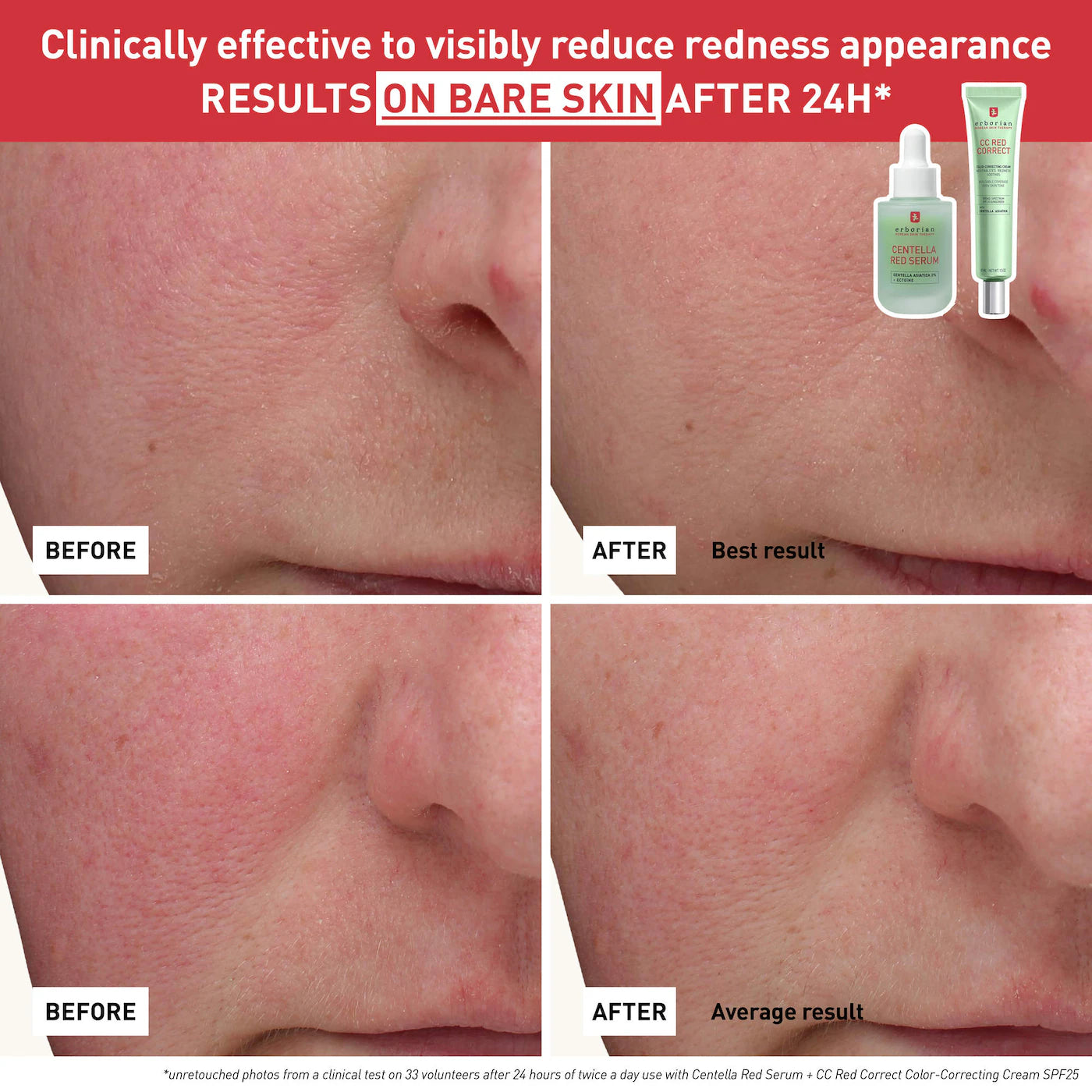 Erborian  CC Red Correct Green Color-Corrector SPF 25 to Cover Redness, with Korean Centella Asiatica Extract - Volare Makeup